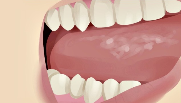 Você está visualizando atualmente A importância dos microrganismos para a Odontologia