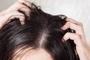 Leia mais sobre o artigo Os cuidados iniciais com o couro cabeludo. Quando começar?
