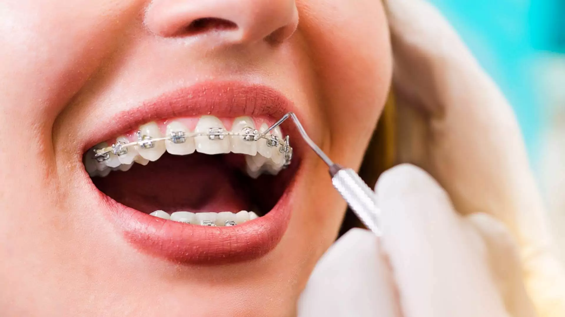 Leia mais sobre o artigo O ortodontista como protagonista da evolução digital