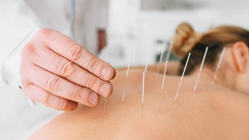 Leia mais sobre o artigo A importância do biomédico acupunturista na saúde e bem-estar