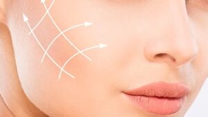 Leia mais sobre o artigo Harmonização facial na Estética