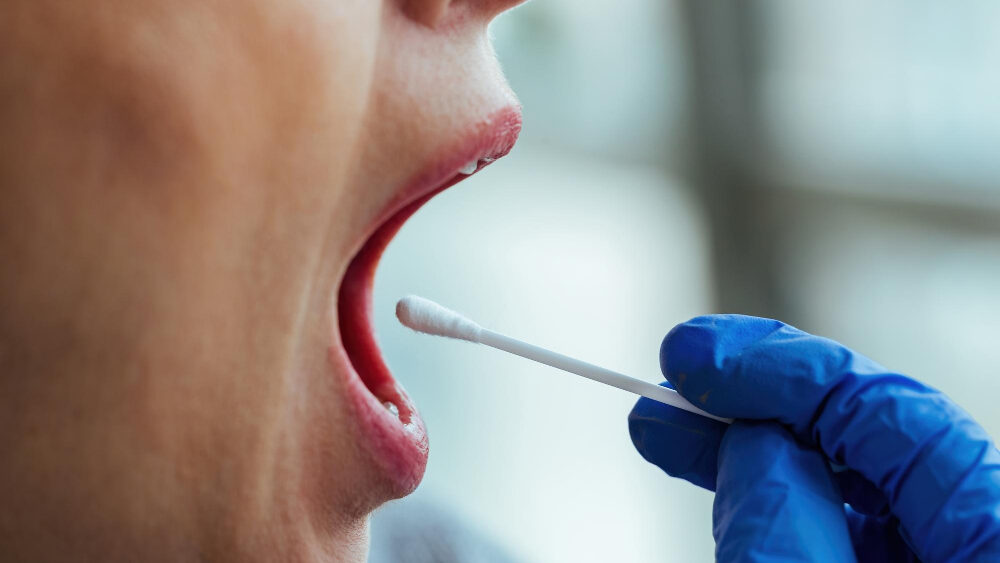 No momento, você está visualizando Saliva: um líquido muito importante para a saúde