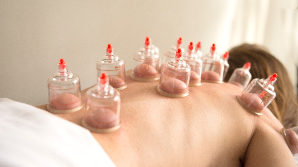 No momento, você está visualizando Terapia por ventosas: ética e conhecimento e profissional