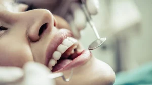 Leia mais sobre o artigo Perder dentes não é normal: saúde não é só estética