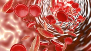 Leia mais sobre o artigo A importância da investigação precoce na anemia ferropriva na prática clínica