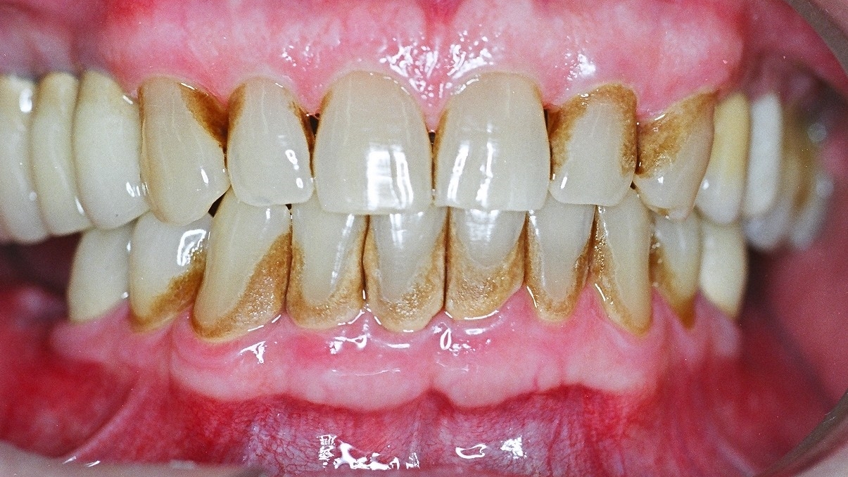 No momento, você está visualizando A revolução invisível: o seu papel como graduando frente à Periodontia além da gengiva
